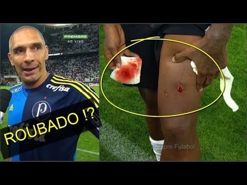 JOGADORES DO PALMEIRAS DESABAFAM APÓS DERBY POLÊMICO - Corinthians 2 x 0 Palmeiras