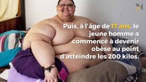 L’homme le plus gros du monde a perdu 250 kilos pour réaliser son rêve : remarcher !
