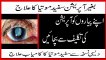 safed motia ka ilaj in urdu | Bagair Operation Motiya (Cataract) ka ilaj - Safed Motia Ka ilaj