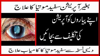 safed motia ka ilaj in urdu | Bagair Operation Motiya (Cataract) ka ilaj - Safed Motia Ka ilaj