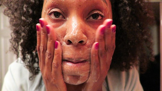 How to remove acne scars with microneedling