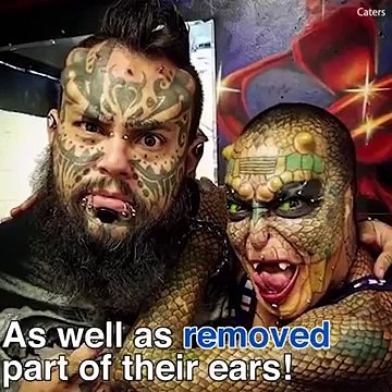 Người phụ nữ chi 1 tỉ đồng để phẫu thuật biến mình thành rồng