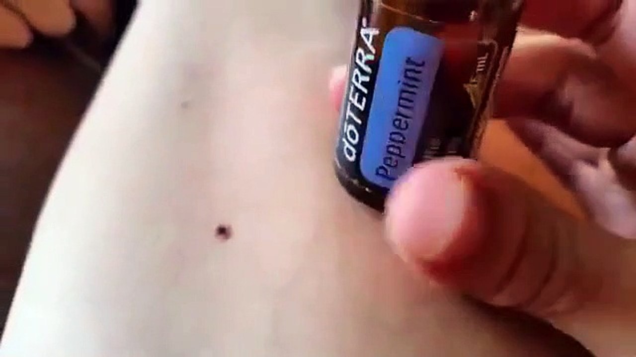 Vücuduna Giren Keneyi Nane Yağıyla Çıkartan Kadının Efsane Videosu!