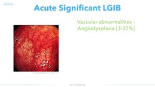 Gastrointestinal - Lower GI Bleeding
