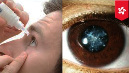 目薬長期使用で白内障に？　マレーシア人の男性 - トモニュース