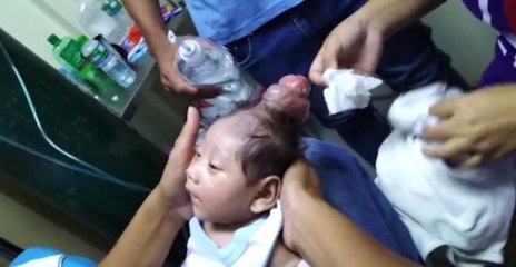 Filipinler'de Boynuzlu Bebek Doğdu!