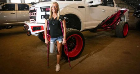 Genç Kadın, Mini Etek Giyebilmek İçin Sağ Bacağını Kestirdi