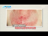 [Happyday]If you have a red face, menopause?! 얼굴이 붉어진다면 갱년기?! [기분 좋은 날] 20171121