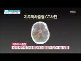 [Happyday]If you have these symptoms stroke?!   이런 증상이라면 나도 뇌졸중?![기분 좋은 날]   20170919