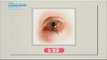 [Happyday] An inflamed eye should heal immediatelyl '눈 충혈', 방치하면 '독' 된다 [기분 좋은 날] 20160119