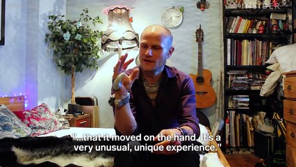 Third Thumb Changes the Prosthetics Game