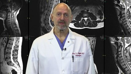 Myelopathy Overview