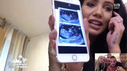L'échographie de Manon Marsault (Marseillais Australia) - ZAPPING PEOPLE DU 06/03/2018