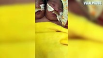 Siamese Twins Born In Cambodia