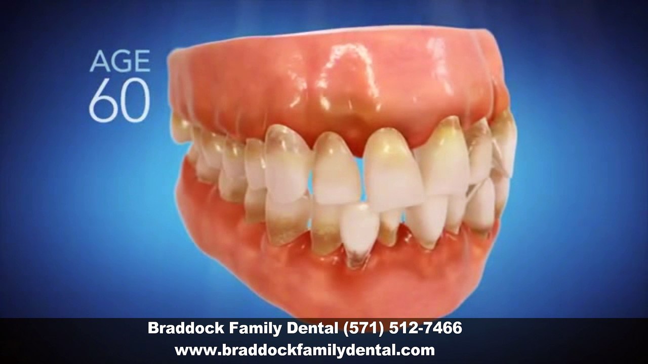 Invisalign Dentist Fairfax VA