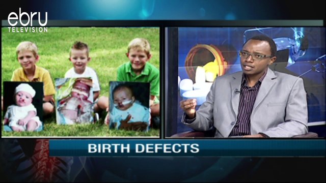 What causes birth defects