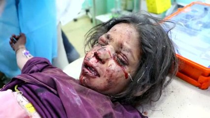 استهداف مدنيين في أكثر من أربعين غارة لقوات التحالف على اليمن