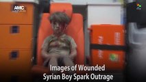 Images of Wounded Syrian Boy Spark Outrage