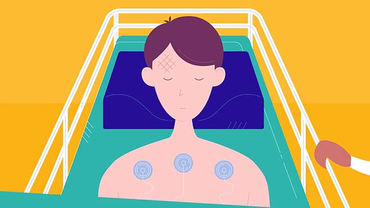 CRASH-3 Race against time to randomise (Lowest MB file)