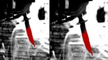 Chennai : A teenage girl stabbed outside her college in KK Nagar | Oneindia News