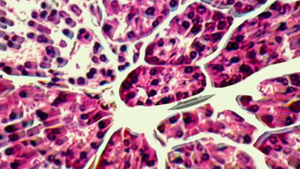 Diabète, à la recherche de l'insuline (Version 2D)