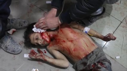 ألف قتيل مدني بالغوطة منذ بدء حرب الإبادة