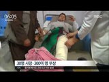 [16/04/20 뉴스투데이] 아프간 폭탄테러로 300여 명 사상, 탈레반 