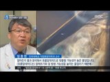 [16/07/30 뉴스데스크] 천연 제품이라더니…인기 모발 영양제에서 '발암 물질'
