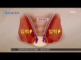 [17/03/26 뉴스데스크] 수험생 위협하는 치질, 중3때 3배 증가…조기 치료 필수