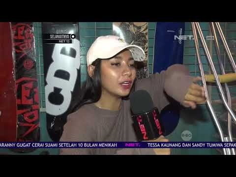 Dinda Kirana Mengalami Patah Tulang Kaki Saat Bermain Skateboard