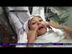 Putri Patricia Menjalani Perawatan 4D Laser Face Lifting