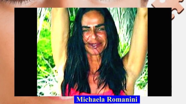 LAS PEORES CIRUGÍAS PLÁSTICAS DE LAS FAMOSAS, QUÉ DESASTRE!!!