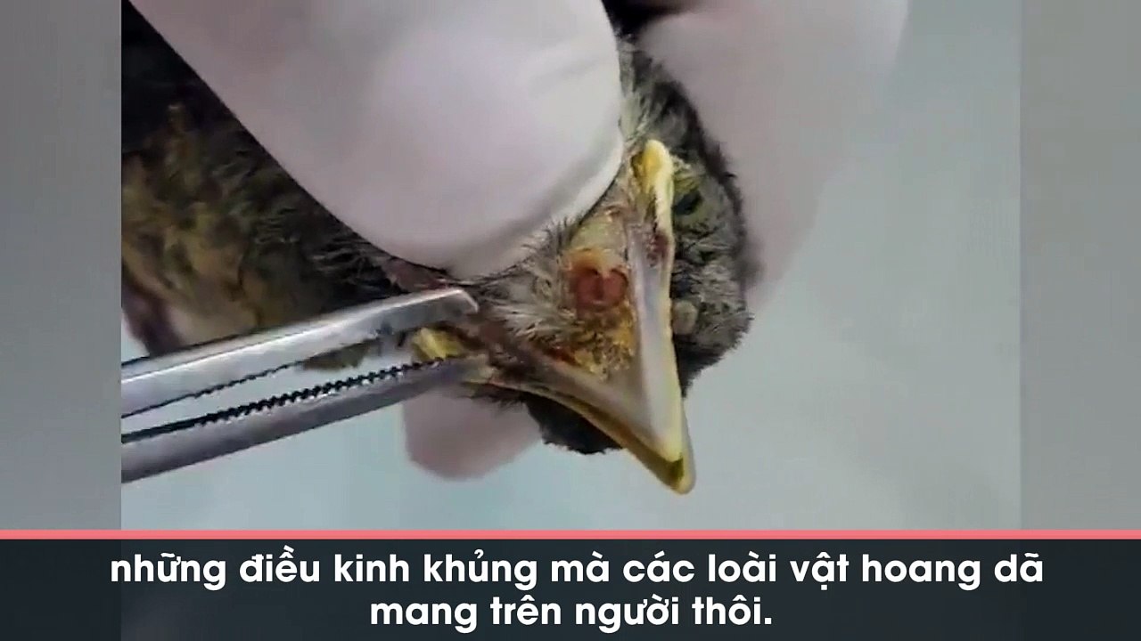 Kinh hoàng cảnh gắp dòi lổn nhổn dành cho những ai... chán xem gắp mụn muốn đổi gió