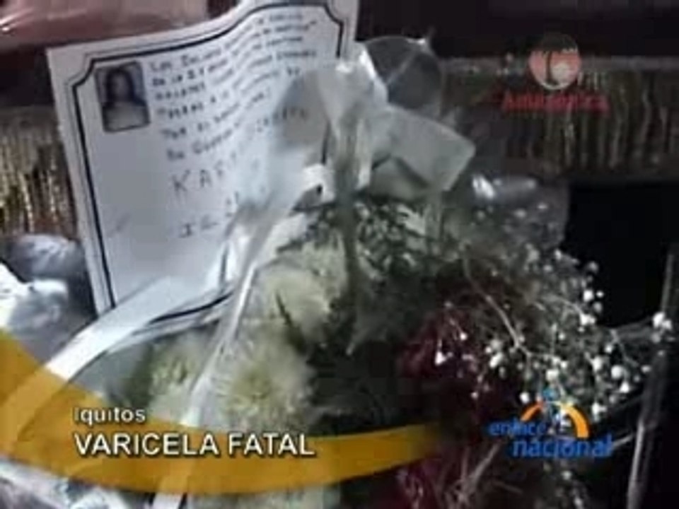VARICELA FATAL - IQUITOS