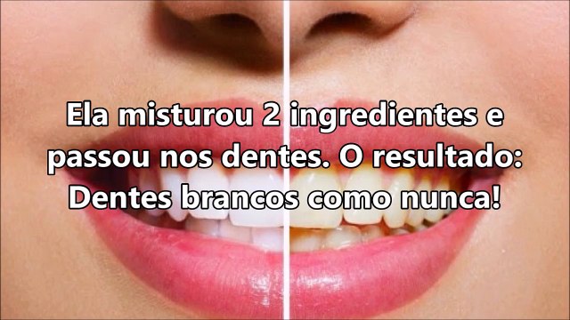Ela misturou 2 ingredientes e passou nos dentes ➜ O resultado_ Dentes brancos como nunca!