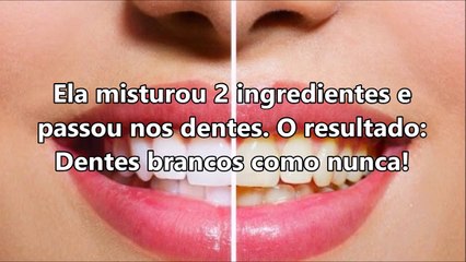 Ela misturou 2 ingredientes e passou nos dentes ➜ O resultado_ Dentes brancos como nunca!