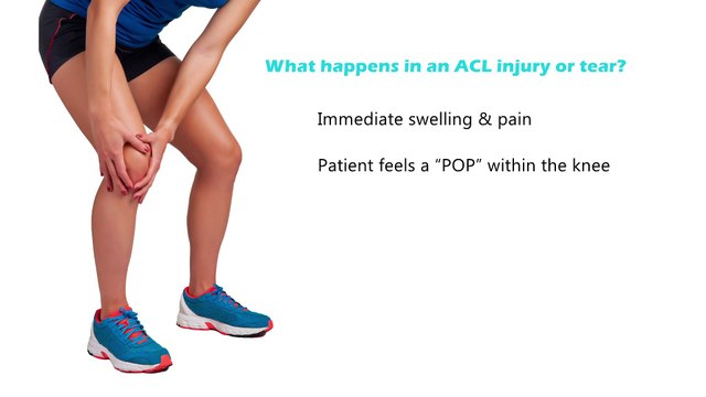 ACL Surgery in India | Anterior Cruciate Ligament