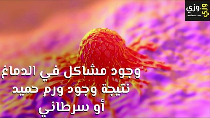 أسباب تنميل الجسم