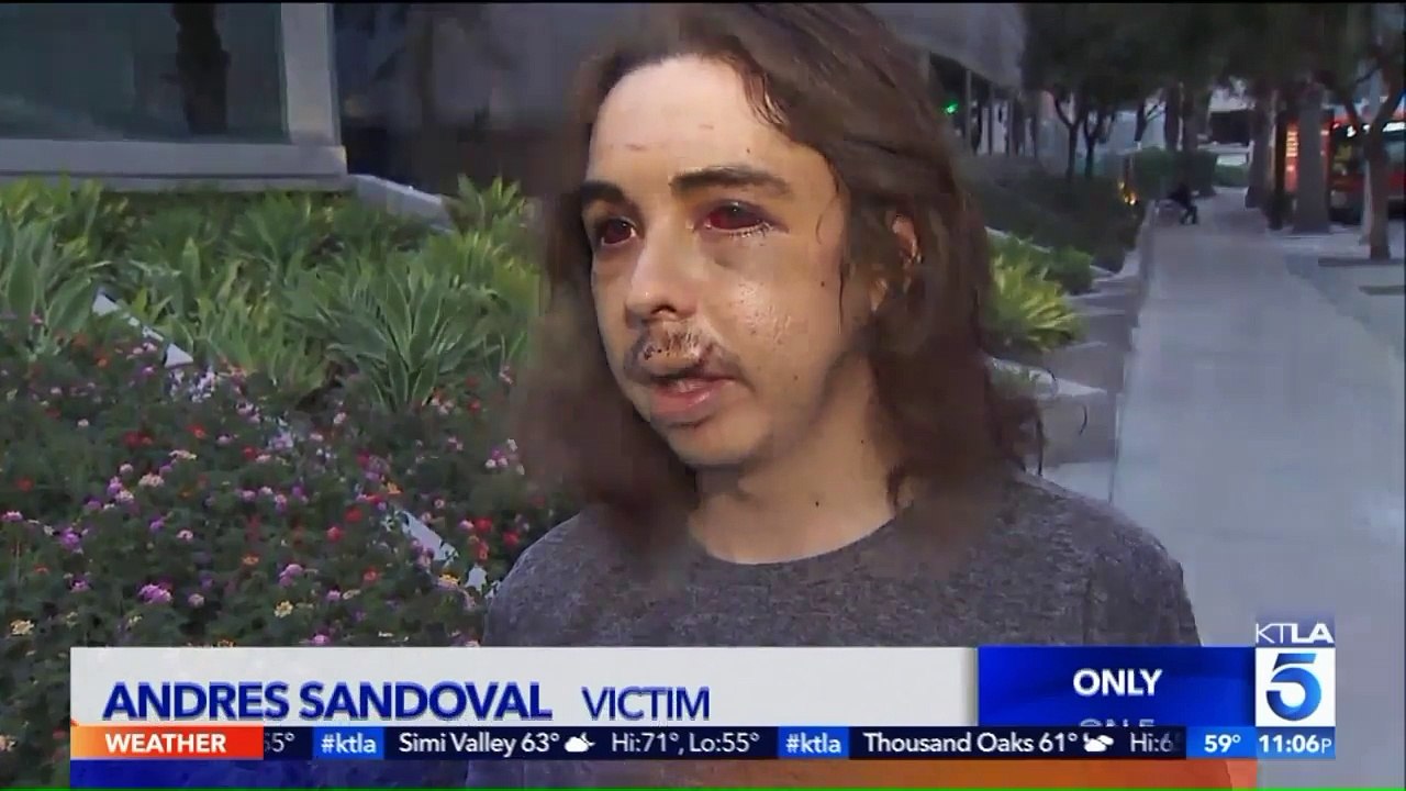 Man Brutally Attacked During Home Invasion