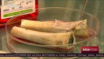 Israeli company says lab-grown bones’ clinical trials a success