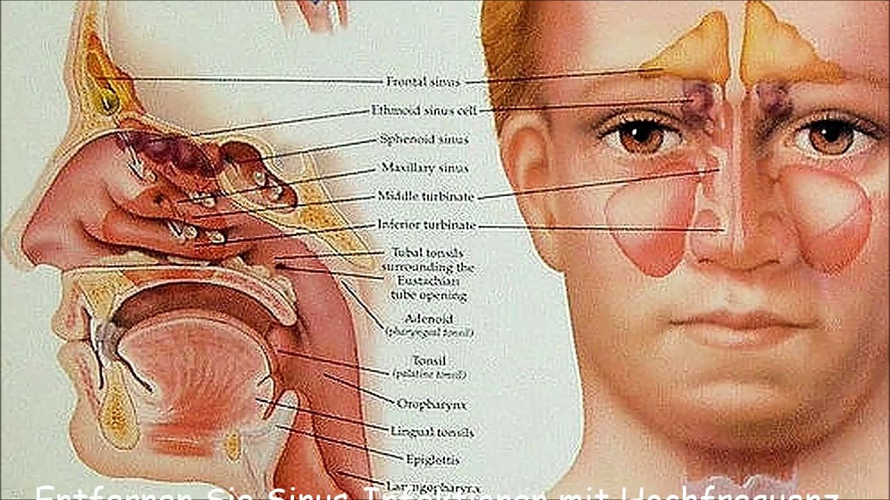 Entfernen Sie Sinus-Infektionen mit Hochfrequenz-Klangtherapie (4400Hz) - 30 Minuten