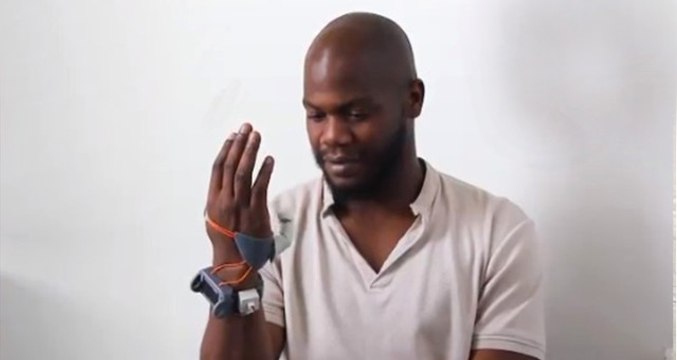 Ekstra Bir Başparmak İster miydiniz? 3 Boyutlu Yazıcı ile Üretilen Parmak Hayatı Kolaylaştıracak