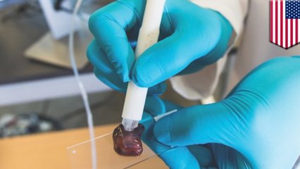 This pen can diagnose cancer in 10 seconds or less