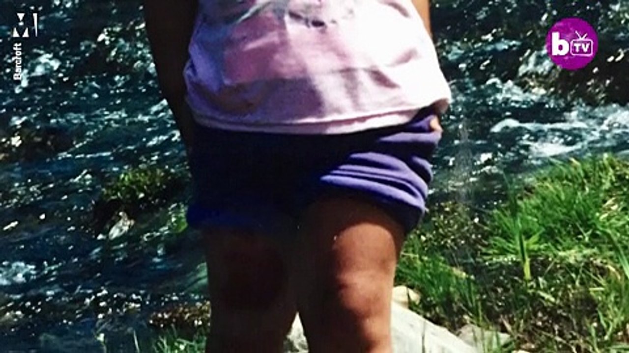 Woman whose swollen legs have made her Insta-famous