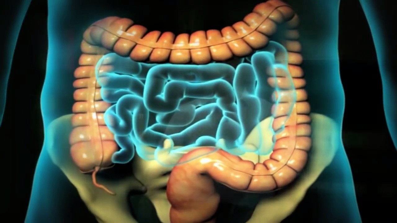 Appendicitis Symptoms, Signs & Removal