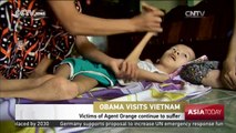 Obama Visits Vietnam: Victims of Agent Orange continue to suffer