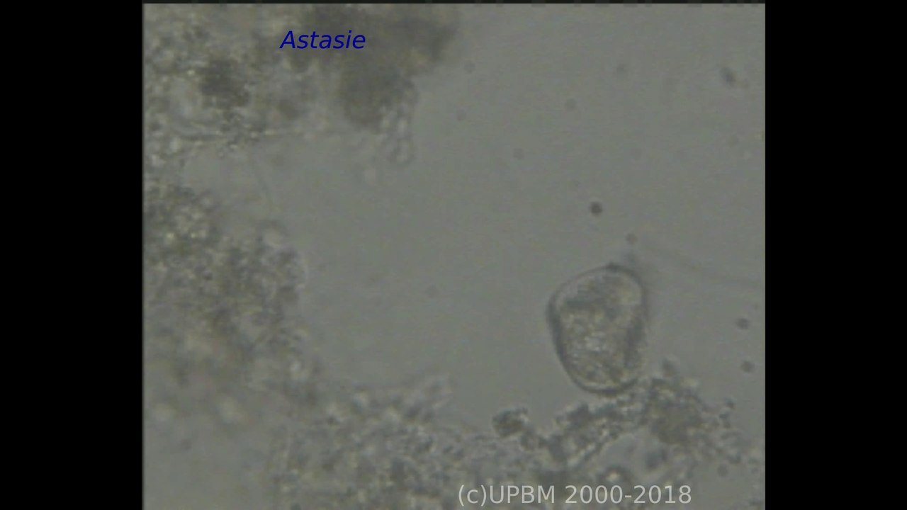 Astasie