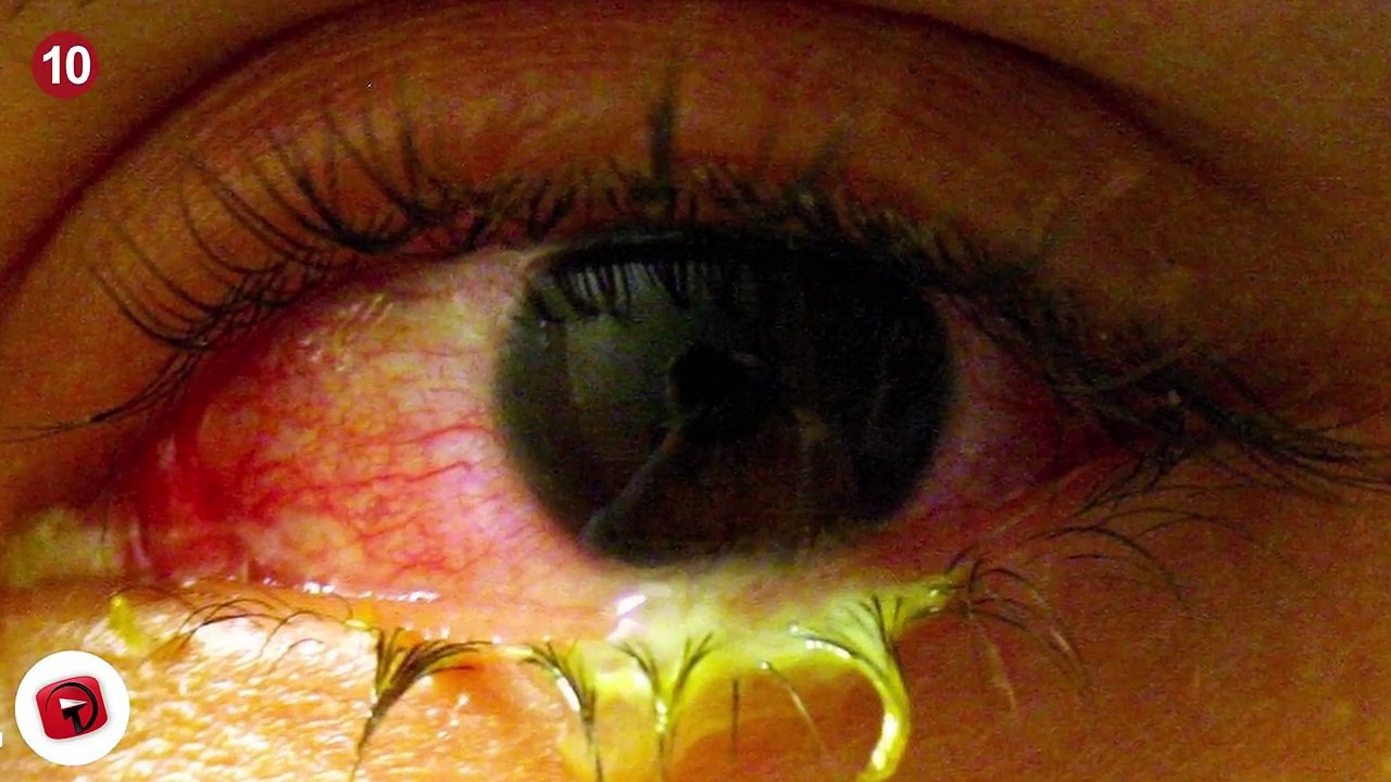 12 Horrifying Things Found Inside A Human Body