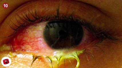 12 Horrifying Things Found Inside A Human Body