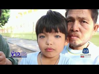 มดสร้างเมือง เด็กตาเพรชตาแมว l ข่าวเวิร์คพอยท์ l 7 เม.ย.60